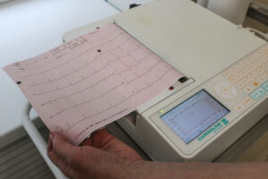 Кардиолог рассказал о различиях между типами инсультов