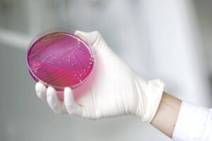 Названы опасные инфекции, обладающие устойчивостью к антибиотикам