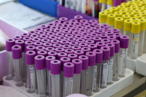 Россиянам напомнили правила сдачи анализов крови